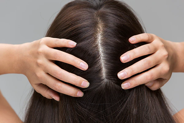 Advanced Hair Restoration